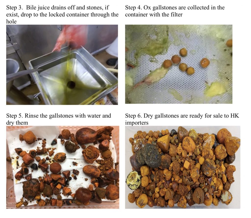 Gallstones for Chinese Herbal Medicine